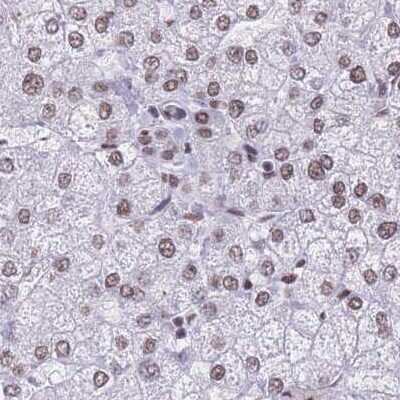 Immunohistochemistry-Paraffin: HNRNPUL1 Antibody [NBP2-47432]