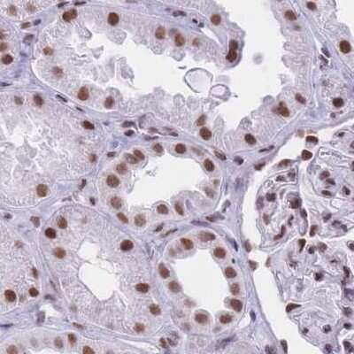 Immunohistochemistry-Paraffin: HNRNPUL1 Antibody [NBP2-47432]
