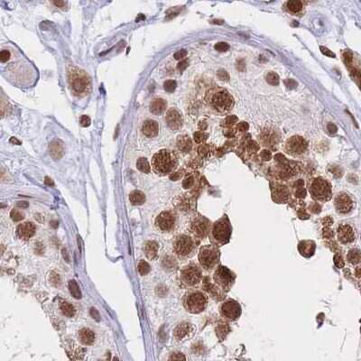 Immunohistochemistry-Paraffin: HNRNPUL1 Antibody [NBP2-47432]