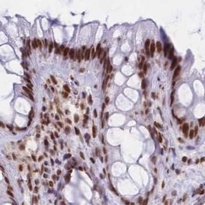 Immunohistochemistry-Paraffin: HNRNPUL1 Antibody [NBP2-47432]
