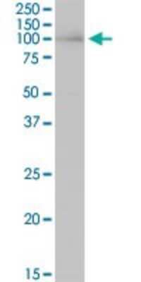 Western Blot: HNRNPUL1 Antibody [H00011100-B01P]