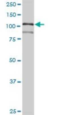 Western Blot: HNRNPUL1 Antibody [H00011100-D01P]