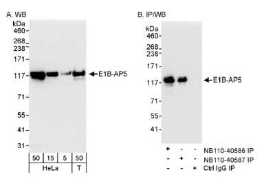 Western Blot: HNRNPUL1 Antibody [NB110-40586]