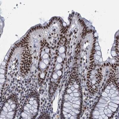 Immunohistochemistry-Paraffin: HNRNPUL2 Antibody [NBP1-92001]