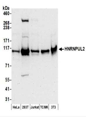 Western Blot: HNRNPUL2 Antibody [NBP2-37687]