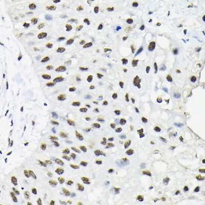 Immunohistochemistry-Paraffin: HNRPA3 Antibody - Azide and BSA Free [NBP3-15982]