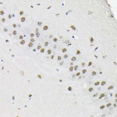 Immunohistochemistry-Paraffin: HNRPA3 Antibody - Azide and BSA Free [NBP3-15982]