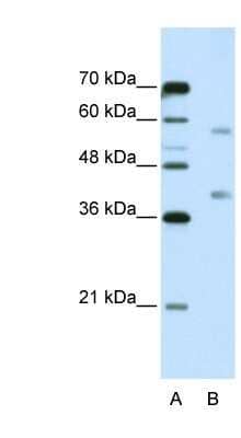 Western Blot: HNRPA3 Antibody [NBP1-80487]