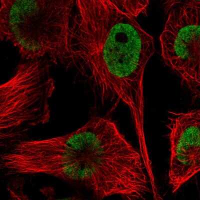 Immunocytochemistry/ Immunofluorescence: HNRPDL Antibody [NBP2-38806]