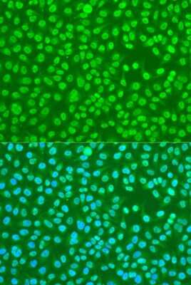 Immunocytochemistry/ Immunofluorescence: HNRPDL Antibody - BSA Free [NBP3-03622]