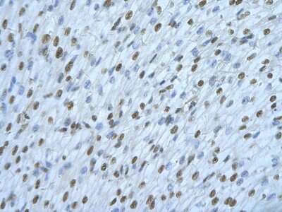Immunohistochemistry: HNRPDL Antibody [NBP1-57156]