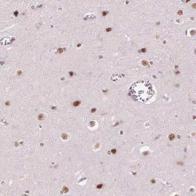 Immunohistochemistry: HNRPDL Antibody [NBP2-38017]