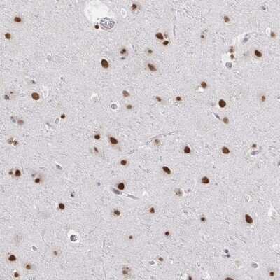 Immunohistochemistry-Paraffin: HNRPDL Antibody [NBP2-38806]