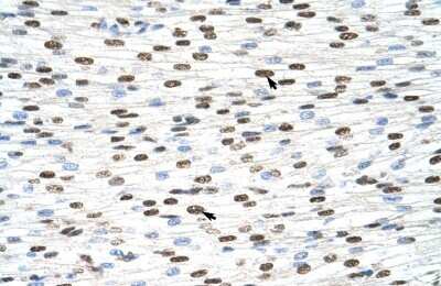 Immunohistochemistry-Paraffin: HNRPDL Antibody [NBP1-57156]