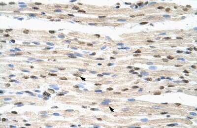 Immunohistochemistry-Paraffin: HNRPDL Antibody [NBP1-57156]