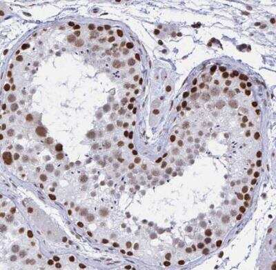 Immunohistochemistry-Paraffin: HNRPDL Antibody [NBP2-38806]
