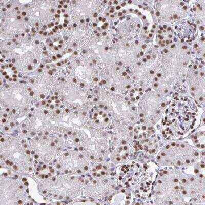 Immunohistochemistry-Paraffin: HNRPDL Antibody [NBP2-38806]