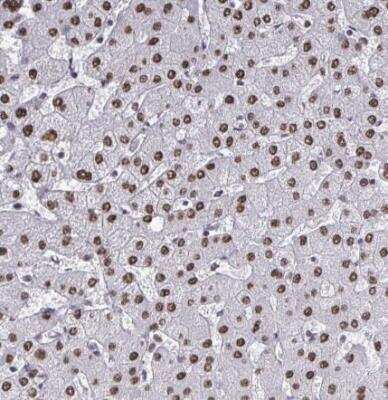 Immunohistochemistry-Paraffin: HNRPDL Antibody [NBP2-38806]