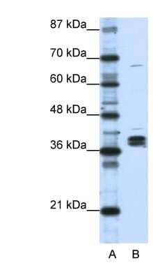 Western Blot: HNRPDL Antibody [NBP1-57156]