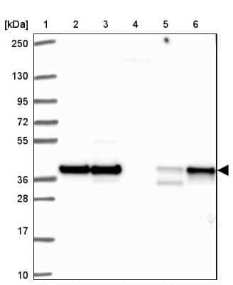 Western Blot: HNRPDL Antibody [NBP2-38806]