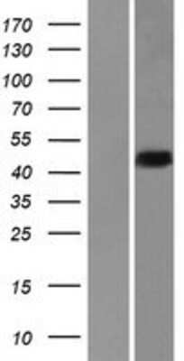 Western Blot: HNRPDL Overexpression Lysate [NBP2-06133]