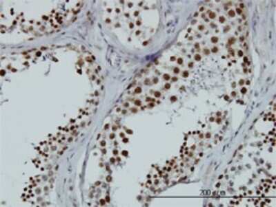 Immunohistochemistry-Paraffin: HNRPGT Antibody (6F11) [H00027288-M01]