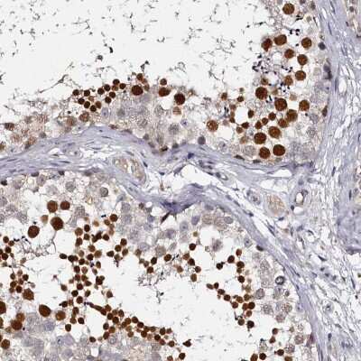 Immunohistochemistry-Paraffin: HNRPGT Antibody [NBP1-92000]