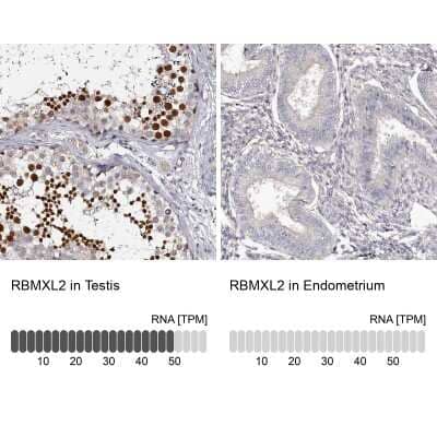 Immunohistochemistry-Paraffin: HNRPGT Antibody [NBP1-92000]