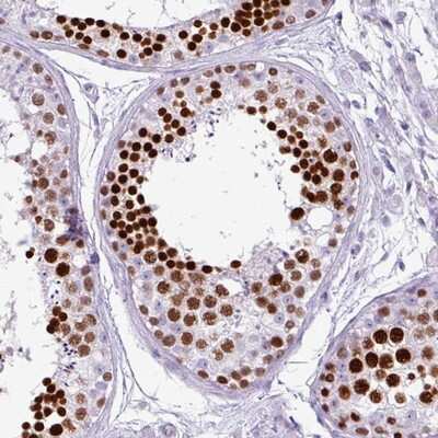 Immunohistochemistry-Paraffin: HNRPGT Antibody [NBP2-13211]