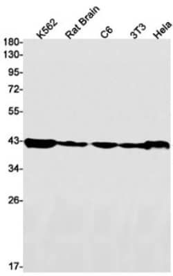 Western Blot: HNRPGT Antibody (S05-2H3) [NBP3-19655]