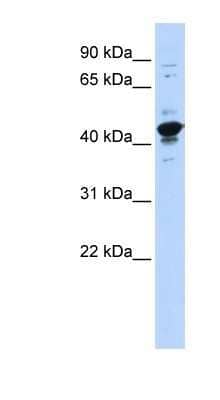 Western Blot: HNRPGT Antibody [NBP1-57164]