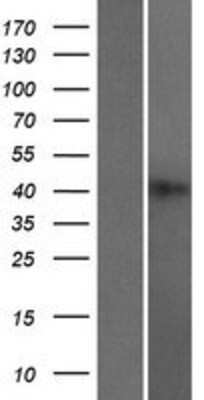 Western Blot: HNRPGT Overexpression Lysate [NBP2-10317]