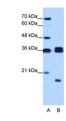 Western Blot: HNRPH3 Antibody [NBP1-57163]