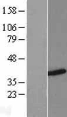 Western Blot: HNRPH3 Overexpression Lysate [NBL1-11644]