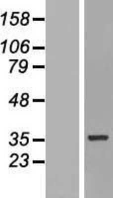 Western Blot: HNRPH3 Overexpression Lysate [NBP2-11294]