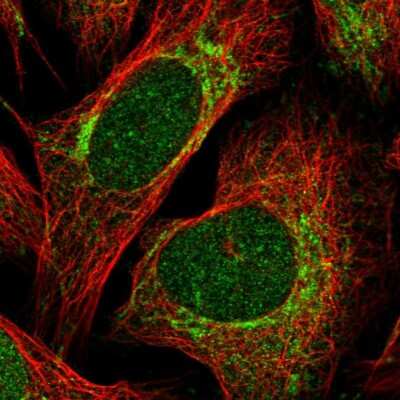 Immunocytochemistry/ Immunofluorescence: HNRPLL Antibody [NBP1-92002]