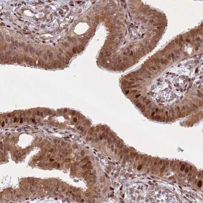 Immunohistochemistry-Paraffin: HNRPLL Antibody [NBP1-92002]