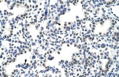 Immunohistochemistry-Paraffin: HNRPLL Antibody [NBP2-85054]