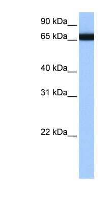 Western Blot: HNRPLL Antibody [NBP1-57407]