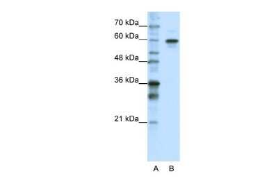 Western Blot: HNRPLL Antibody [NBP2-85054]