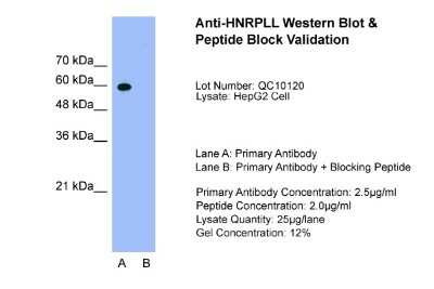 Western Blot: HNRPLL Antibody [NBP2-85054]