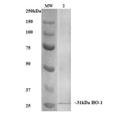 Western Blot: HO-1/HMOX1/HSP32 Antibody (6B8-2F2) [NBP2-59338]