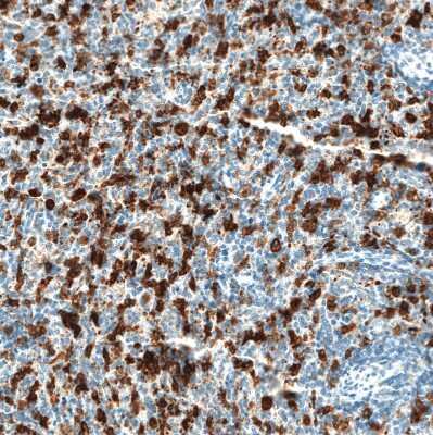 Immunohistochemistry-Paraffin: HO-1/HMOX1/HSP32 Antibody (CL11669) [NBP3-15122]