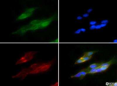 Immunocytochemistry/ Immunofluorescence: HO-1/HMOX1/HSP32 Antibody - BSA Free [NBP1-77459]