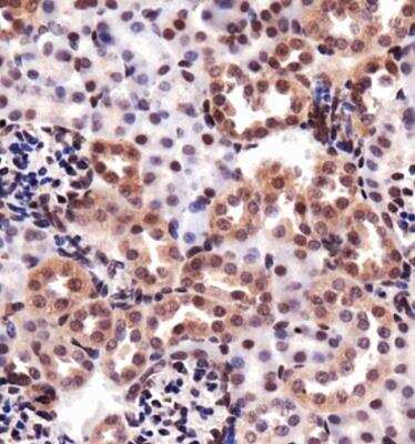 Immunohistochemistry: HO-1/HMOX1/HSP32 Antibody - BSA Free [NBP1-77459]