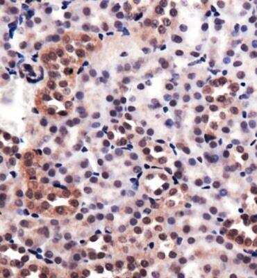 Immunohistochemistry: HO-1/HMOX1/HSP32 Antibody - BSA Free [NBP1-77460]