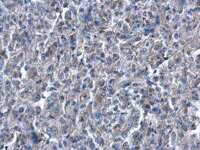 Immunohistochemistry-Paraffin: HO-1/HMOX1/HSP32 Antibody [NBP1-31341]