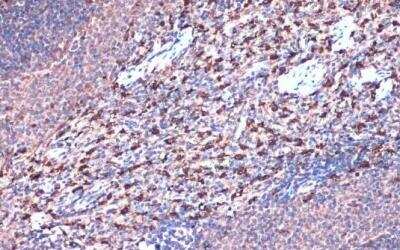 Immunohistochemistry-Paraffin: HO-1/HMOX1/HSP32 Antibody [NBP1-31341]