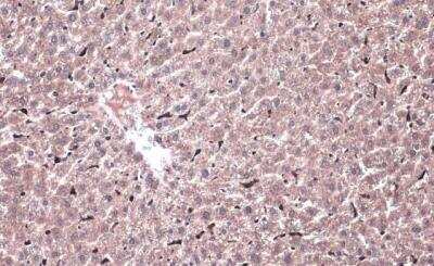 Immunohistochemistry-Paraffin: HO-1/HMOX1/HSP32 Antibody [NBP1-31341]