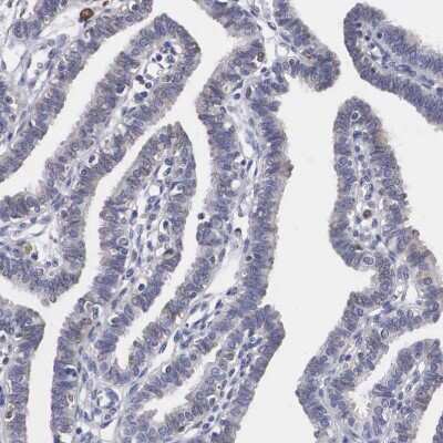 Immunohistochemistry-Paraffin: HO-1/HMOX1/HSP32 Antibody [NBP1-89964]